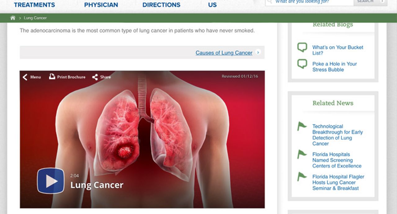 A page focused on lung cancer has a ViewMedica embed toggled to the lung cancer video.