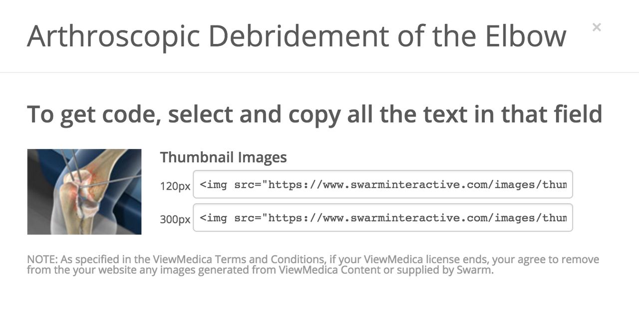 The thumbnail for the video is also available.