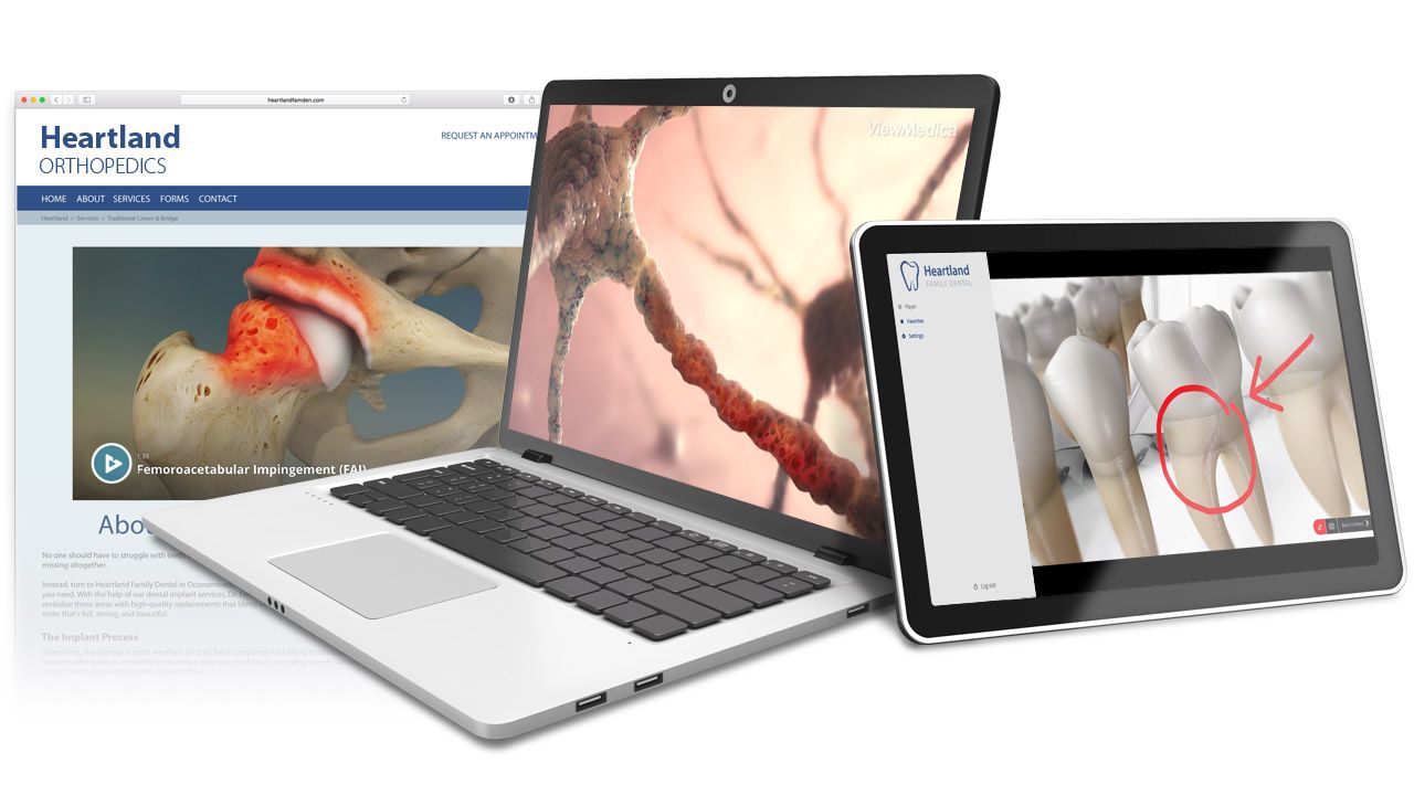 ViewMedica On-Demand brings patient education videos to your website and to macOS, iOS, Windows, and Android devices in your practice.