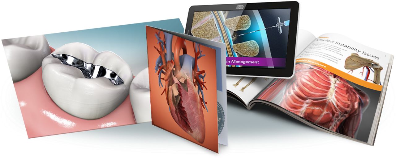 ViewMedica Stock Images can be used in digital products like websites, videos, and ebooks as well as print products like books, magazines, and other publications.