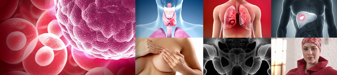 Various images from cancer patient education videos