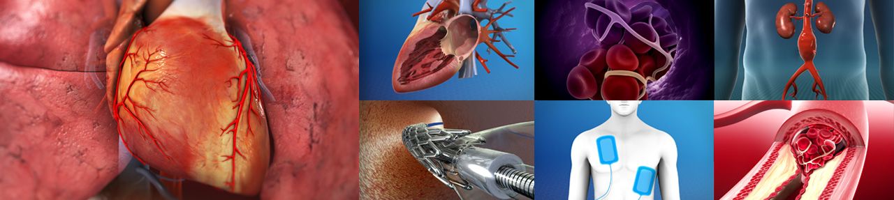 Various images from cardiovascular patient education videos