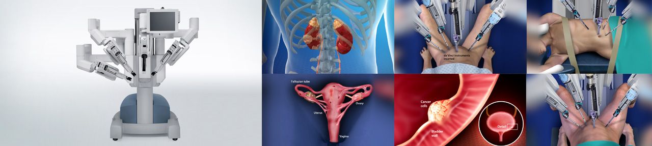 Various images from da vinci® surgical system patient education videos