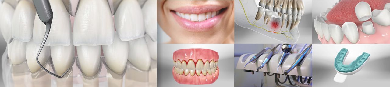 Various images from dental patient education videos