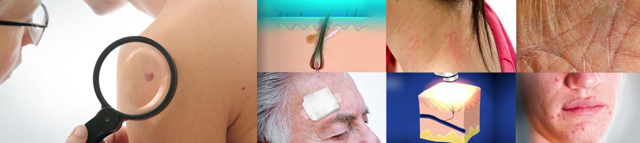 Various images from dermatology patient education videos