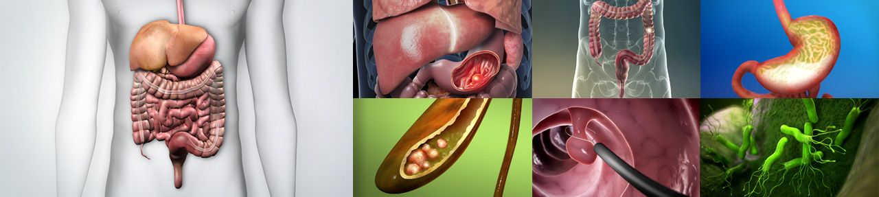 Various images from gastrointestinal patient education videos