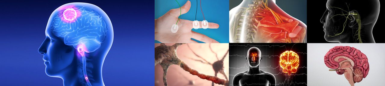 Various images from neurological patient education videos