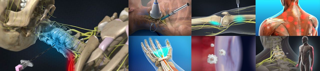 Various images from pain management patient education videos
