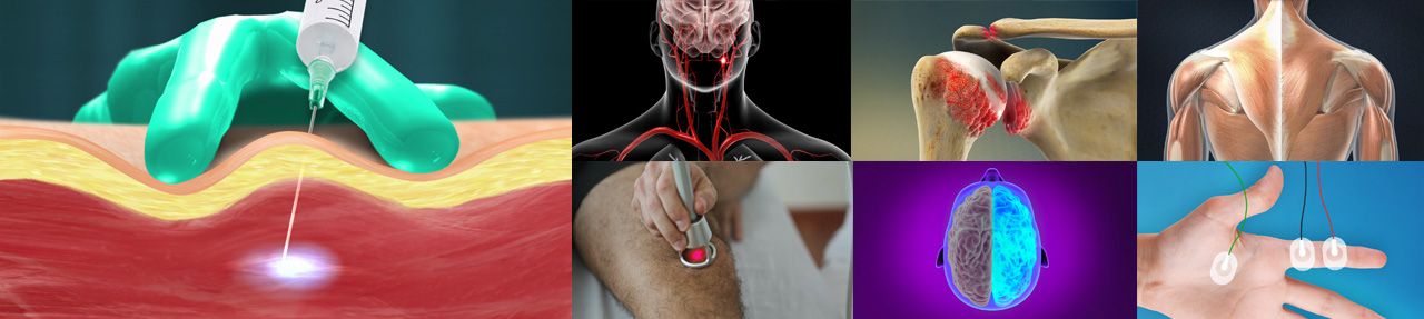 Various images from physiatry patient education videos