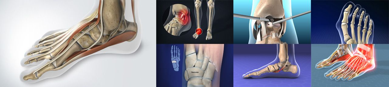 Various images from podiatry patient education videos
