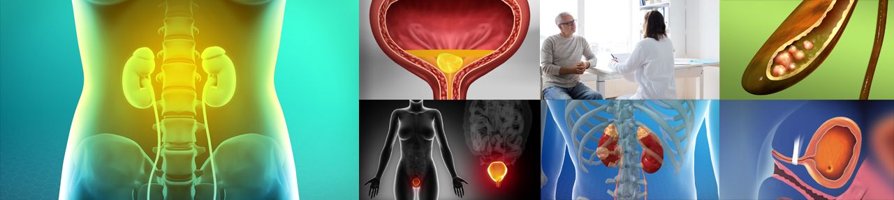 Various images from urology patient education videos