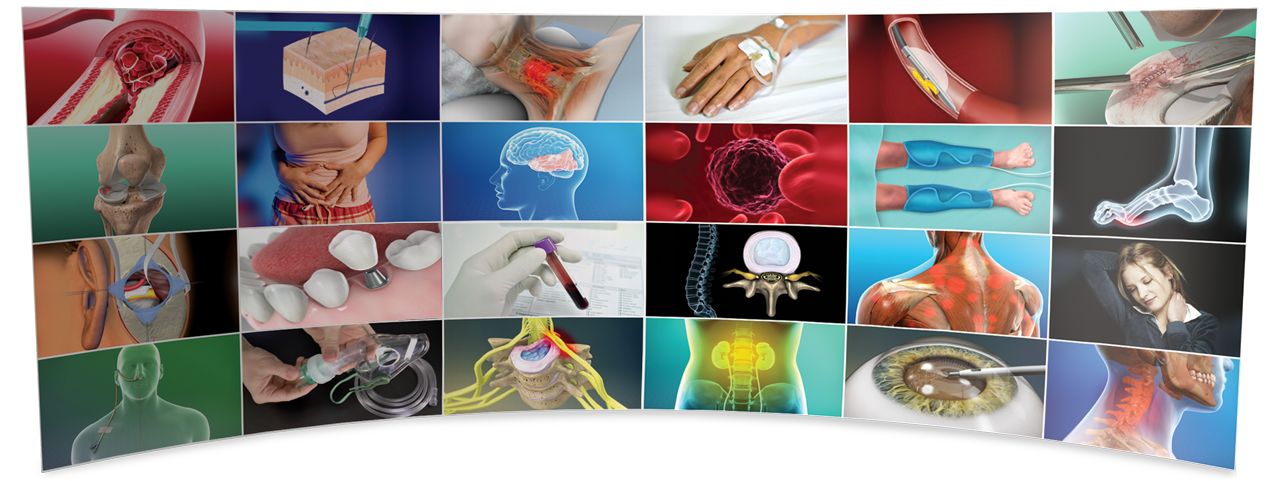 ViewMedica videos cover a variety of topics.