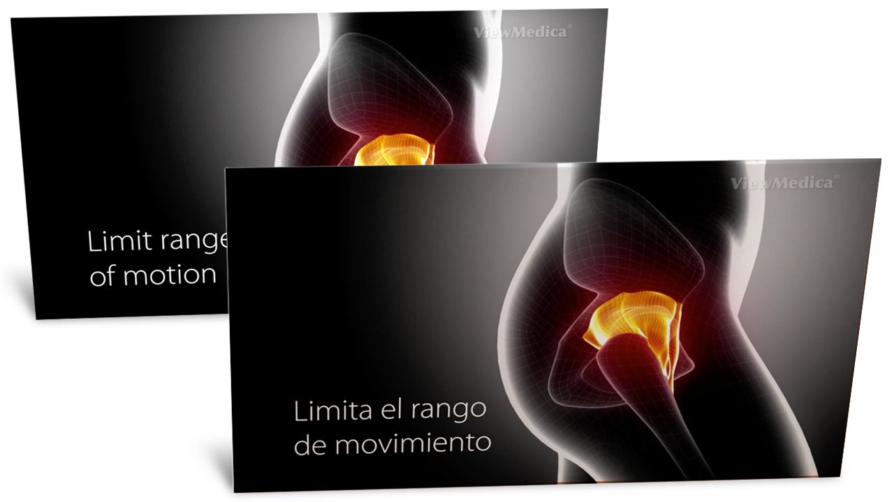 ViewMedica videos are available in English and Spanish.